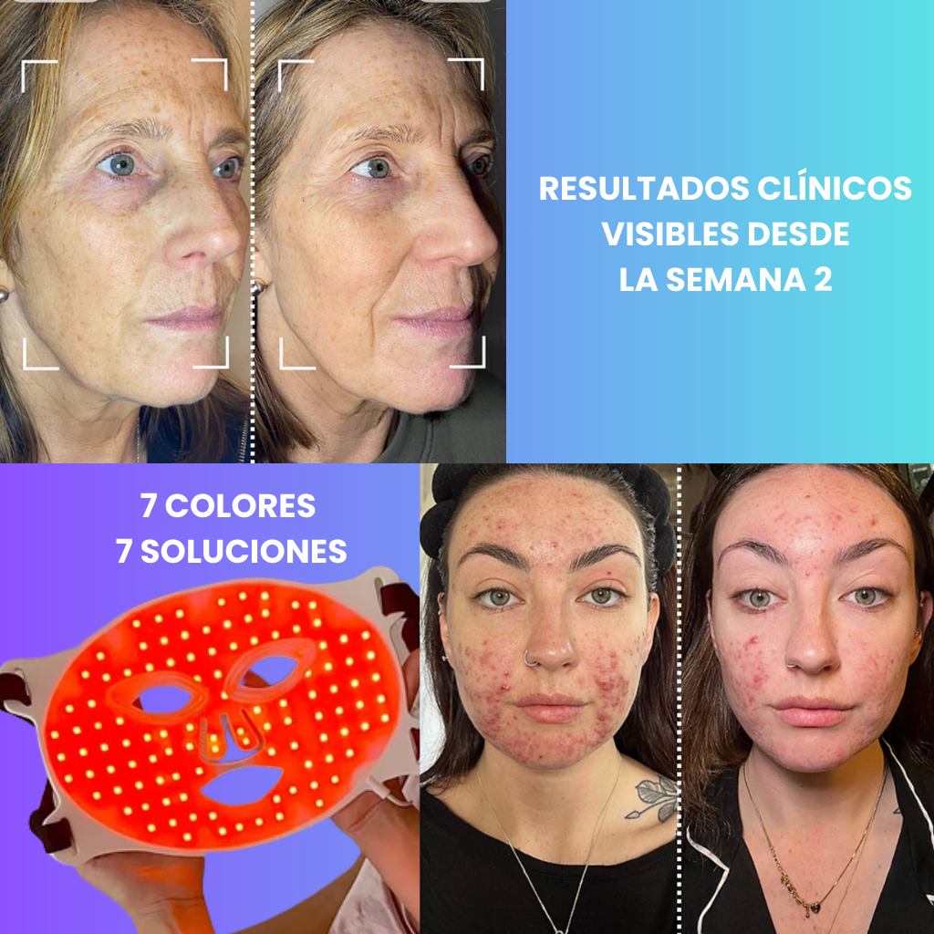 MASCARA FACIAL LED 7 COLORES